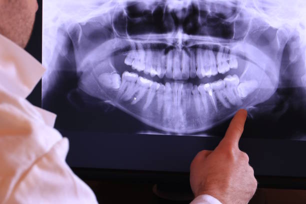 Best After-Hours Emergency Dentist in Crandon Lakes, NJ