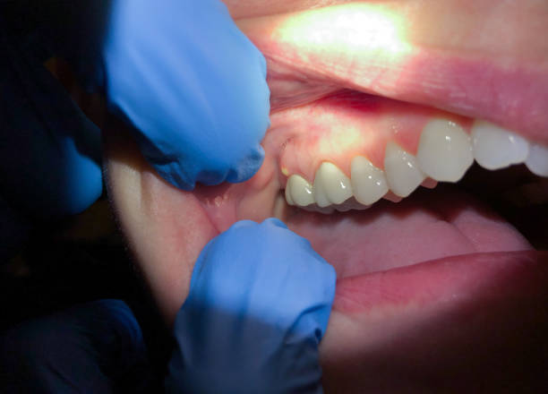 Best Emergency Dental Care for Trauma or Injury in Crandon Lakes, NJ